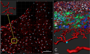 Neurolucida software: Filament reconstruction was utilized to render microglia; The blue sphere indicated the soma of the microglia; Courtesy to Mary Lourdes Andreu (Helen Bramlett Lab).
