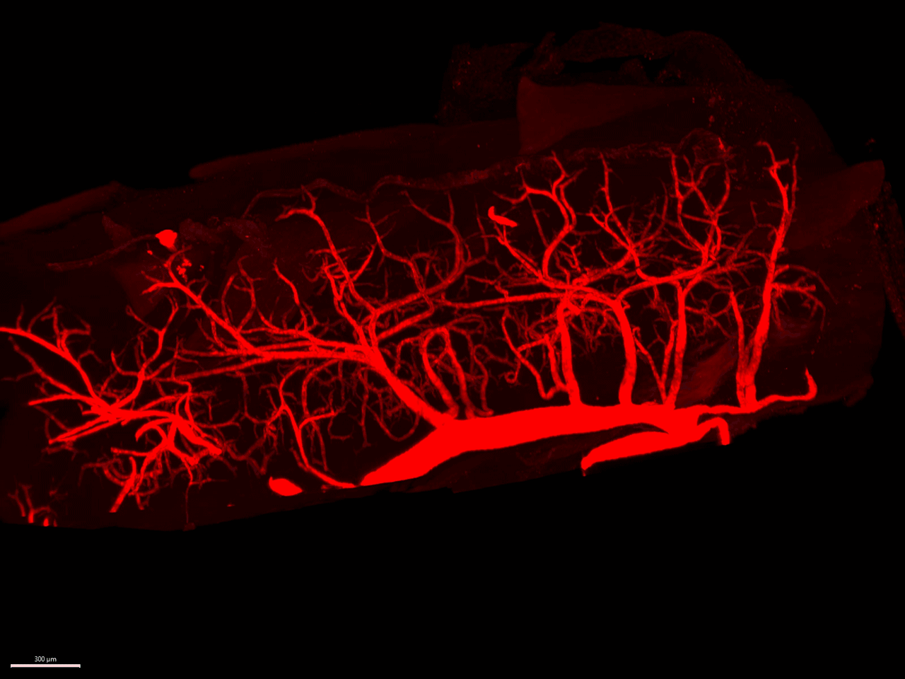 Blood vessels in mouse spinal cord imaged using LightSheet and visualized using Imaris. Video provided courtesy of Tatyana Camejo (Pantelis Tsoulfas Lab).